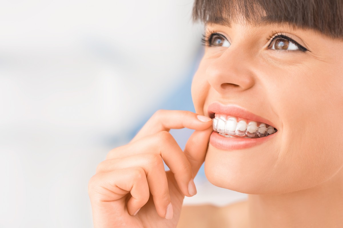 Ortodontik tedavide şeffaf plak sistemleri