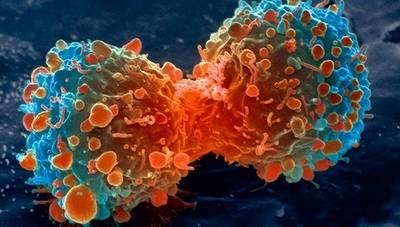 Kanserli hücrelerin 'yenmesini' sağlayan ilaç üretildi