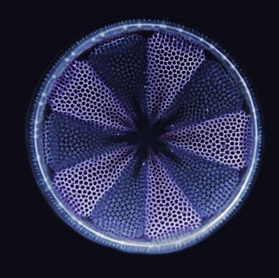 Tam olarak 125 mikron uzunluğunda, Actinoptychus heliopelta