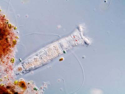 Mikroskobik dünyaya küçük bir dalış