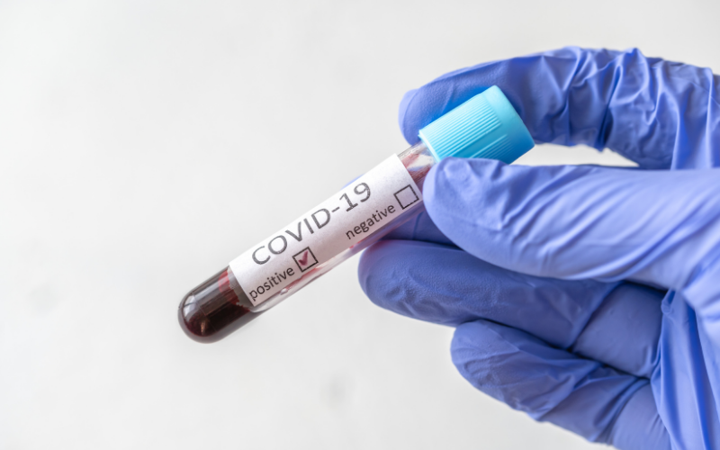 Koronavirüs Testinde Sonuç Nasıl Anlaşılıyor?
